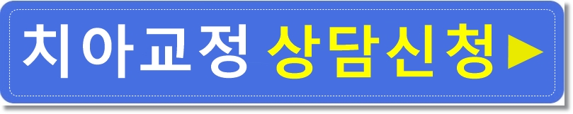 돌출입 치아교정전후. 갸름하고 세련된 입술을 되찾다! 관련 이미지 6