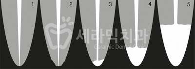 치아교정 부작용 제대로 알기 1. 관련 이미지 7