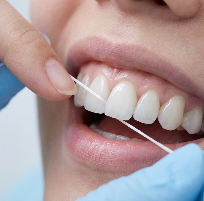 A Case of Improving the Smile Line Along with Replacing a Front Tooth Crown image 9