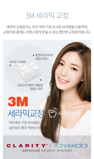 세라믹치과에서 세라믹교정이 인기있는 이유! 관련 이미지 5
