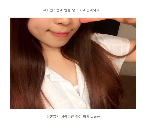 세라믹치과 홍수빈님 다시교정하기 관련 이미지 5