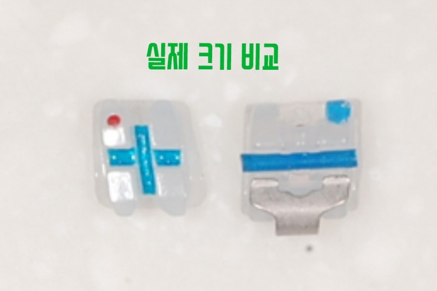 클리피씨교정 기간 짧을까? 관련 이미지 11