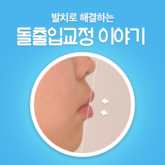 학동역치과 치아교정은 여기서 !! 관련 이미지 2