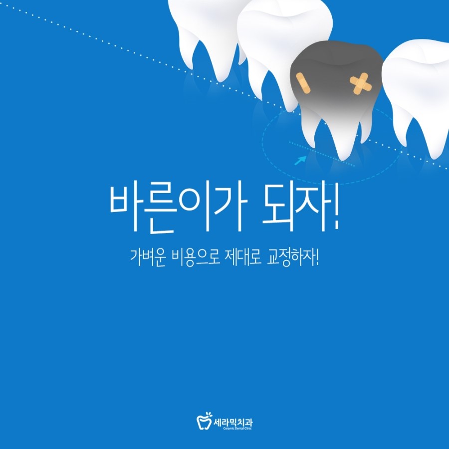 세라믹교정 비용 부작용없이 관련 이미지 2