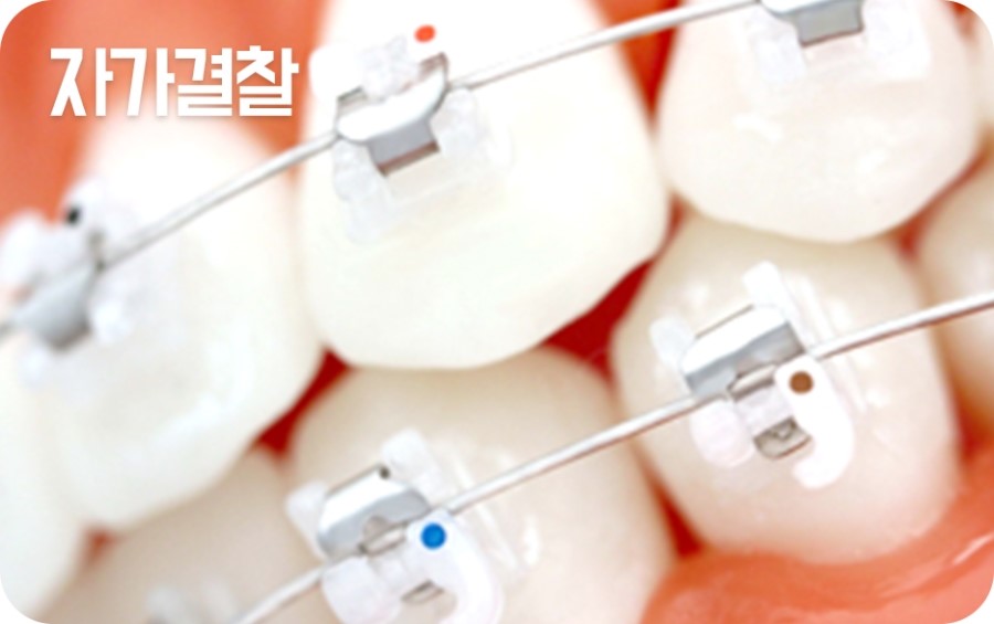 교정장치 구분하기 관련 이미지 4