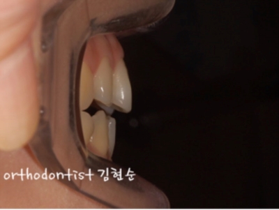 강남교정치과 관련 이미지 10