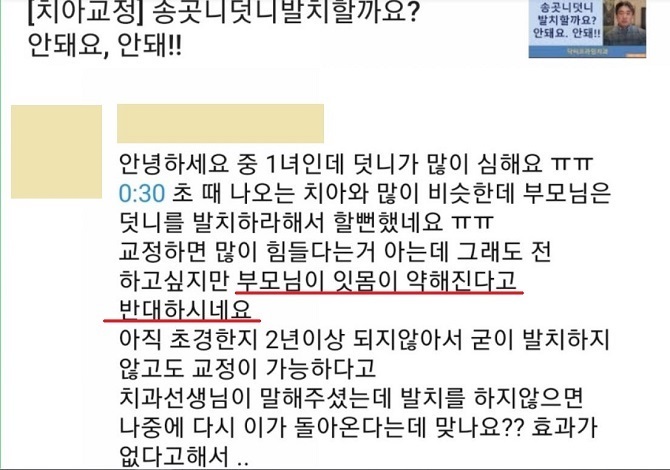 중학생덧니교정이 필요한 이유 3가지! 관련 이미지 6