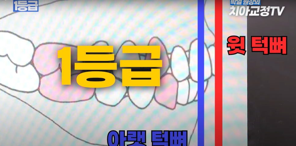 예뻐지는 교정 ? 미용 교정 후 예뻐지는 조건 & 등급 총정리! 관련 이미지 4