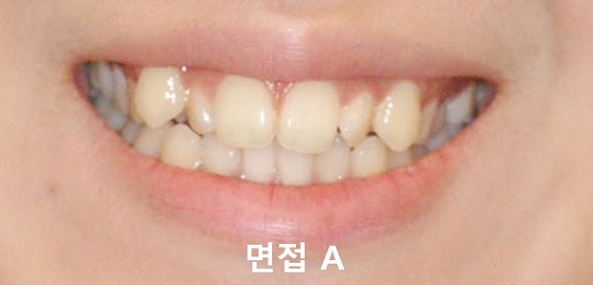 면접과 미소! 관련 이미지 6