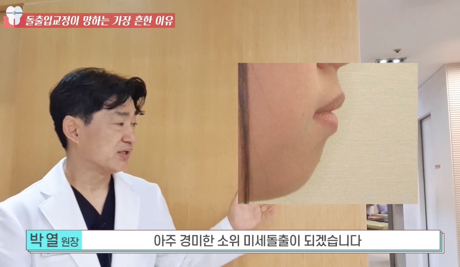 돌출입 교정치과 옥니 돌출입 치아 교정 왜 망할까? 관련 이미지 14