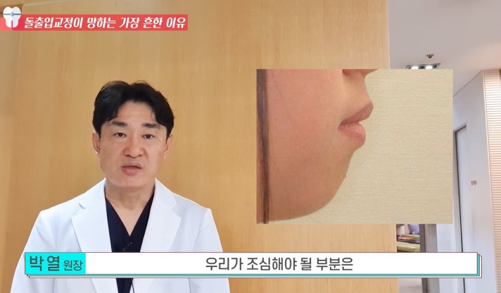 돌출입 교정치과 옥니 돌출입 치아 교정 왜 망할까? 관련 이미지 15