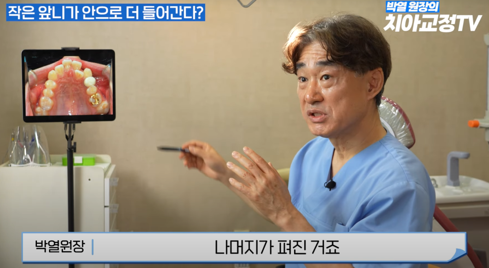 강남역 교정치과 :: 앞니 교정 시작 전에 꼭 알아야 할 한 가지 사실! 관련 이미지 13
