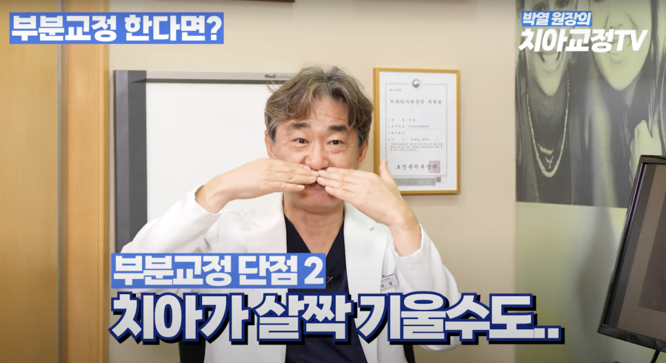 강남역 부분교정 치과 어디로 갈지 고민이라면? 관련 이미지 6