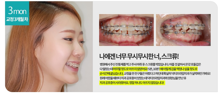 [돌출입교정전후] 앞니돌출교정사례 관련 이미지 2