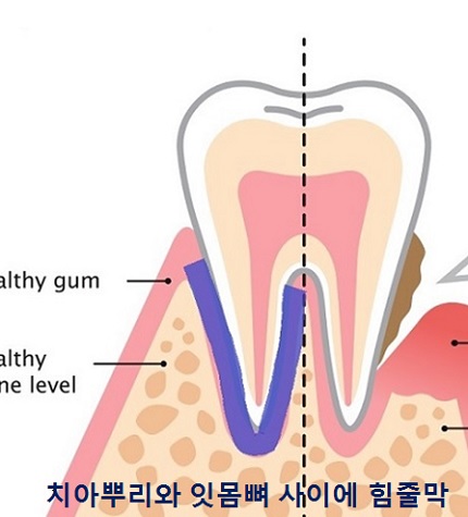교정시작을 망설이게 하는 치아교정통증(2) 관련 이미지 2