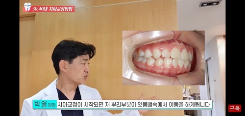 30,40대 성인교정은 이렇게 달라요! 관련 이미지 4