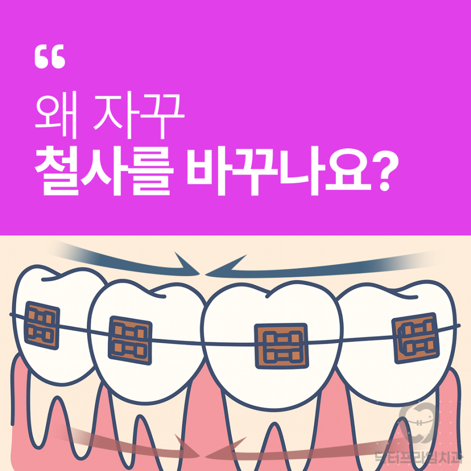 Gangnam Station Orthodontics: Why Do They Keep Changing the Wire? image 14
