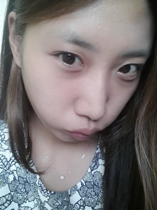 덧니교정후기(13) 완전 시컴둥이가 되버렸어용 .... 관련 이미지 2