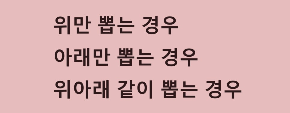 교정발치에 대하여 관련 이미지 2