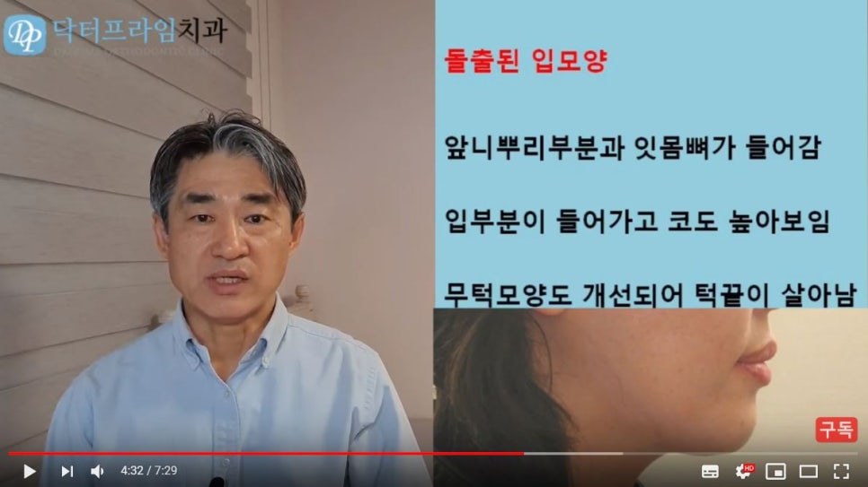 얼굴이 이뻐지는 치아교정! (덧니, 비대칭, 돌출입) 관련 이미지 10