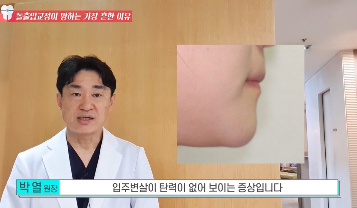 돌출입 교정치과 옥니 돌출입 치아 교정 왜 망할까? 관련 이미지 7