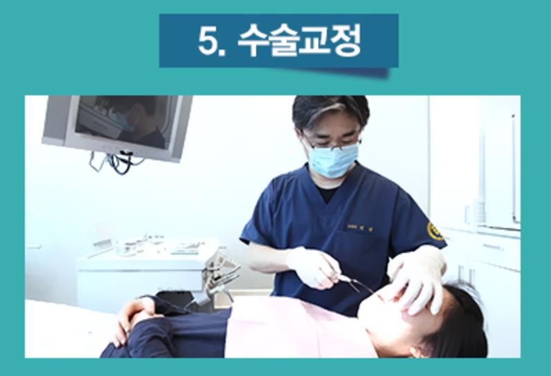치아교정의 종류 4가지 1) 세라믹교정 2) 클리피시교정 3)설측교정 4) 투명교정 관련 이미지 5