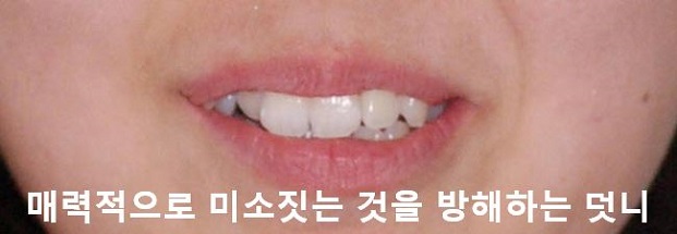 매력적으로 미소짓는 법! 관련 이미지 7