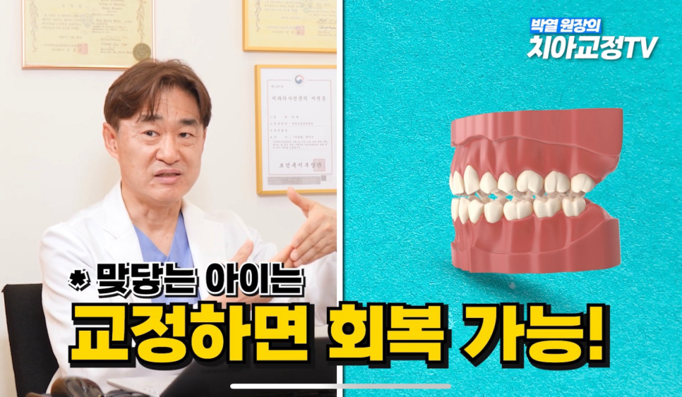Can Adult Crossbite Be Treated With Orthodontic Dental Care? image 29