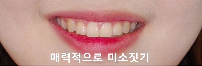 매력적으로 미소짓는 법! 관련 이미지 2