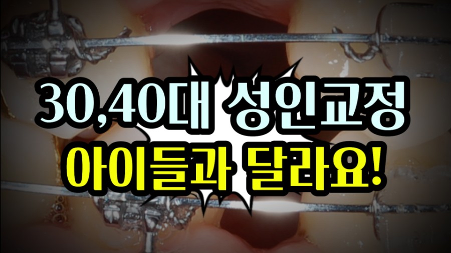 30,40대 성인교정은 이렇게 달라요! 관련 이미지 1