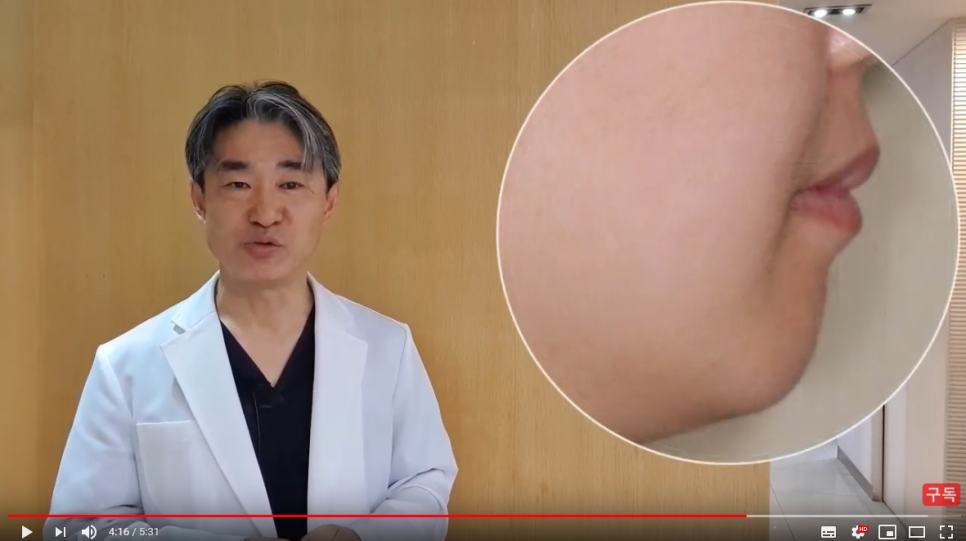 돌출입교정용나사(미니스크류) 많이 아파요? 관련 이미지 7