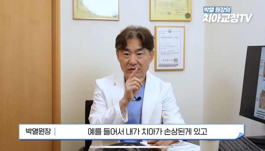 강남역치아교정, 신경치료 받은 치아도 교정이 될까? 관련 이미지 3