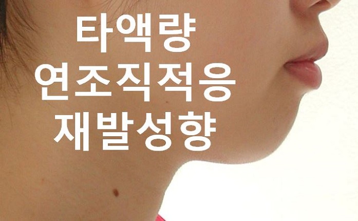 돌출입교정의 효과적인 시기! 관련 이미지 12
