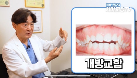 닥터프라임치과 성인 치아 교정 장점은? 관련 이미지 16