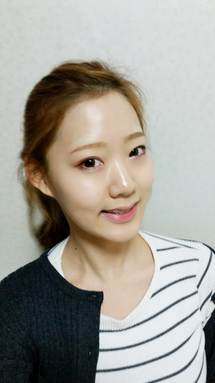 [치아교정후기] 앞니돌출교정후기(15) 관련 이미지 4