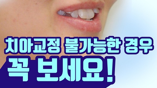 덧니교정 불가능한 경우! 관련 이미지 1