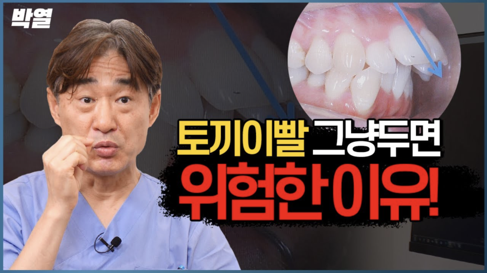 강남역 교정치과 토끼 이빨 교정해야할까? 관련 이미지 1