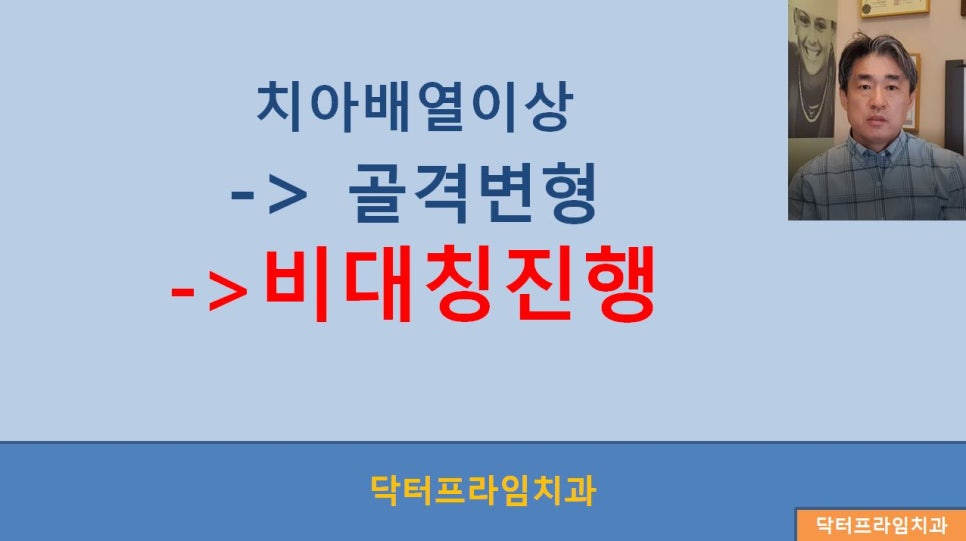 [치아교정] 치아교정과 안면비대칭, 교정시기(초등학생~성인) 관련 이미지 2