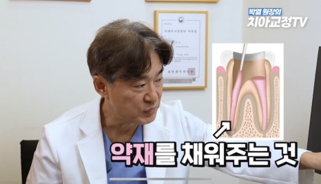 강남역치아교정, 신경치료 받은 치아도 교정이 될까? 관련 이미지 9