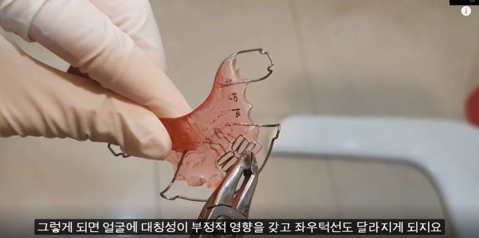 [치아교정] 소아교정=1차교정=턱교정. 비슷한 개념입니다 관련 이미지 4