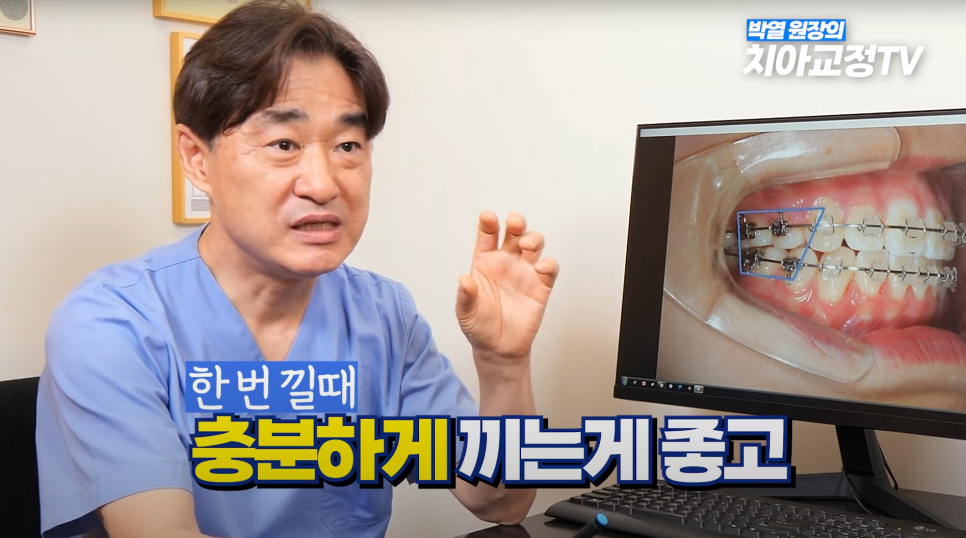 교정 고무줄, 그냥 끼는 게 아닙니다! 위치&middot;시간&middot;지속이 핵심입니다. 관련 이미지 13