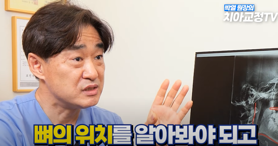 예뻐지는 교정 ? 미용 교정 후 예뻐지는 조건 & 등급 총정리! 관련 이미지 12