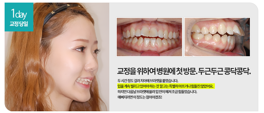 교정첫방문 두근두근, 콩닥콩닥 관련 이미지 2