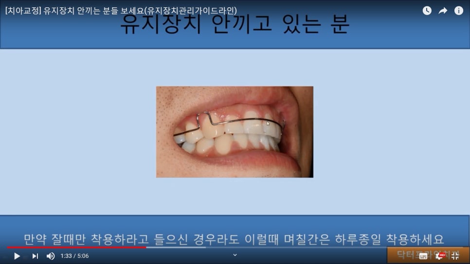 [치아교정] 유지장치 안끼고 있는 분들은 꼭 보세요!! 관련 이미지 3