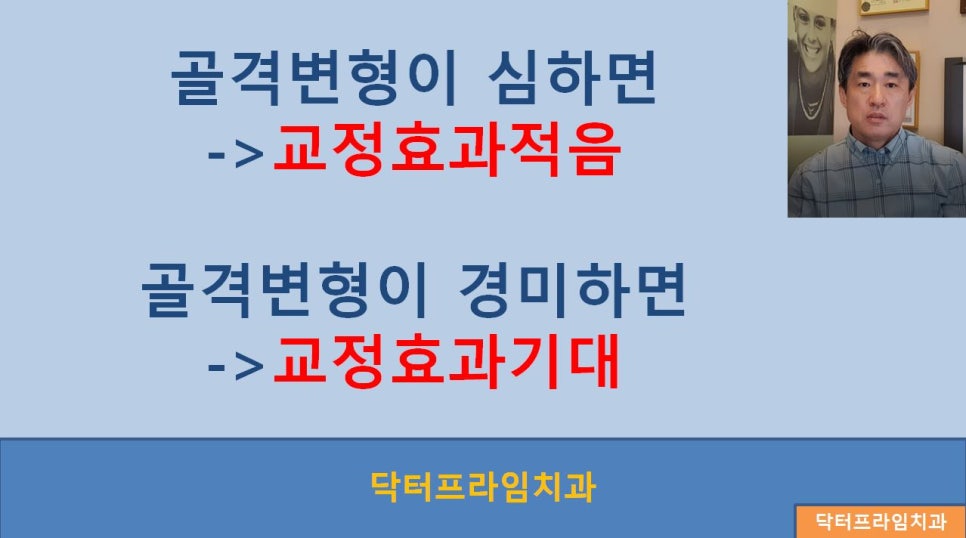[치아교정] 치아교정과 안면비대칭, 교정시기(초등학생~성인) 관련 이미지 3