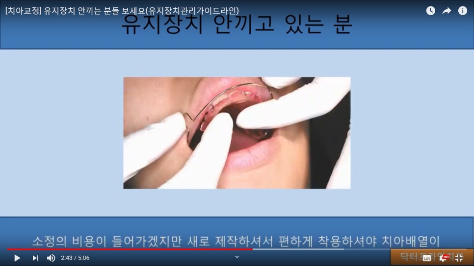 [치아교정] 유지장치 안끼고 있는 분들은 꼭 보세요!! 관련 이미지 4