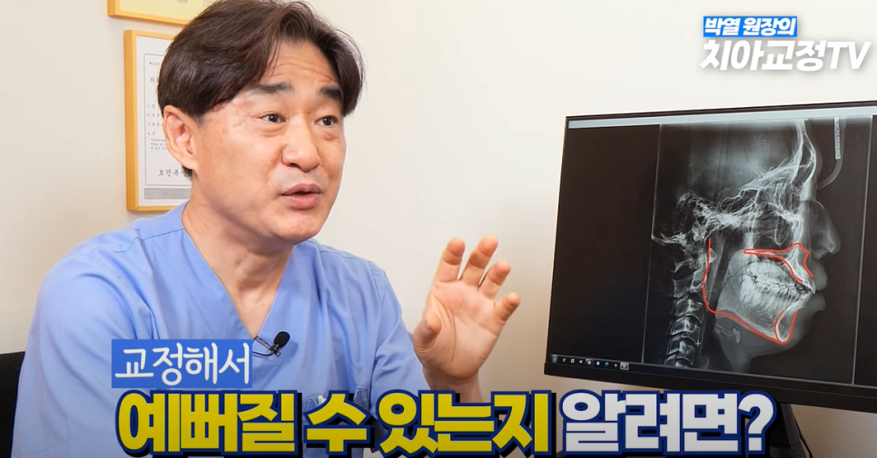 예뻐지는 교정 ? 미용 교정 후 예뻐지는 조건 & 등급 총정리! 관련 이미지 11