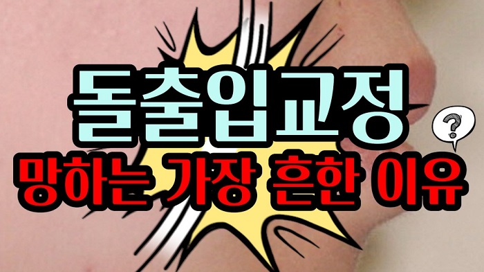 돌출입교정을 망하게 하는 이유! 관련 이미지 1