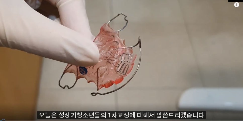 [치아교정] 소아교정=1차교정=턱교정. 비슷한 개념입니다 관련 이미지 2