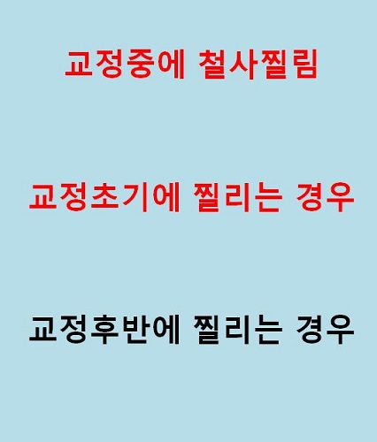 교정철사찔림의 해결방법!(닥터프라임치과) 관련 이미지 2